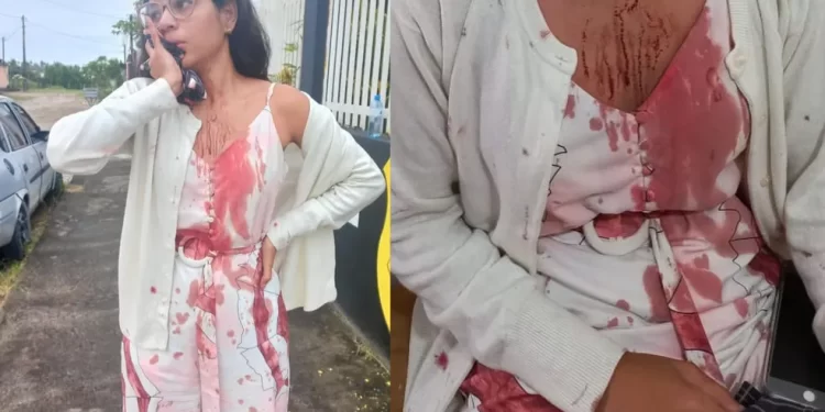 Jovem tem rosto cortado enquanto dormia durante viagem em ônibus na Bahia: ‘poderia estar morta’