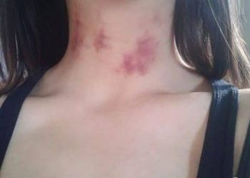 Homem sai para o bar e mulher é atacada por lobisomem na zona rural de São Mateus