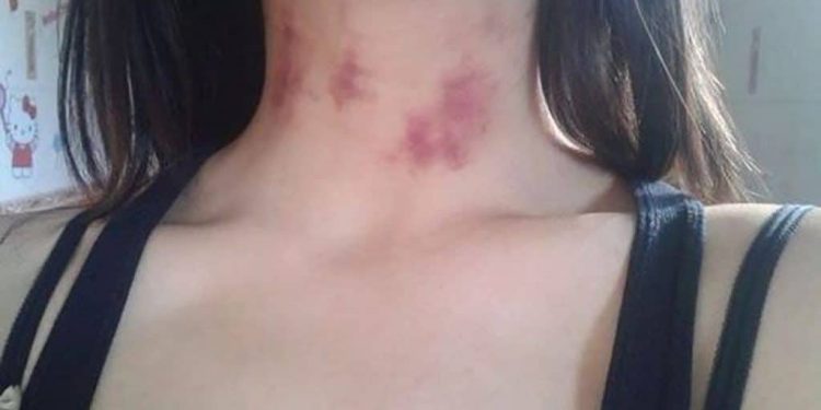 Homem sai para o bar e mulher é atacada por lobisomem na zona rural de São Mateus